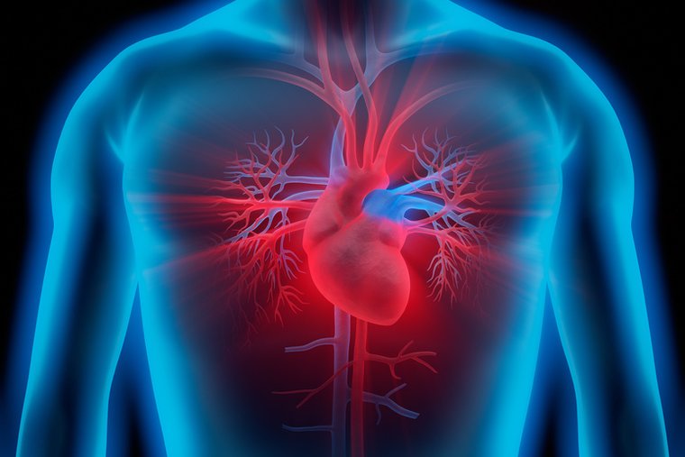 Grafik Herzkatheter