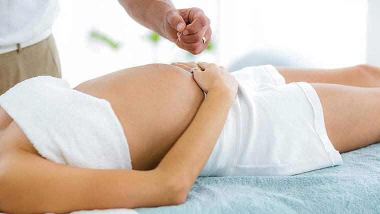 Geburtsvorbereitende Akupunktur