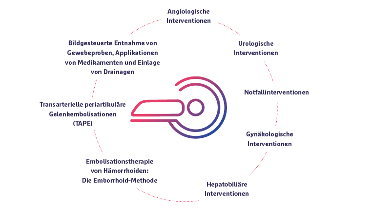 Interventionelle Radiologie Grafik